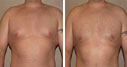Before & After Photos